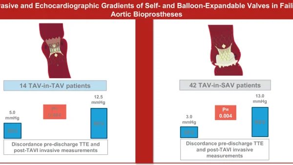 Echocardiografie overschatte drukgradiënten na TAV-in-TAV met ballon-expandable kleppen